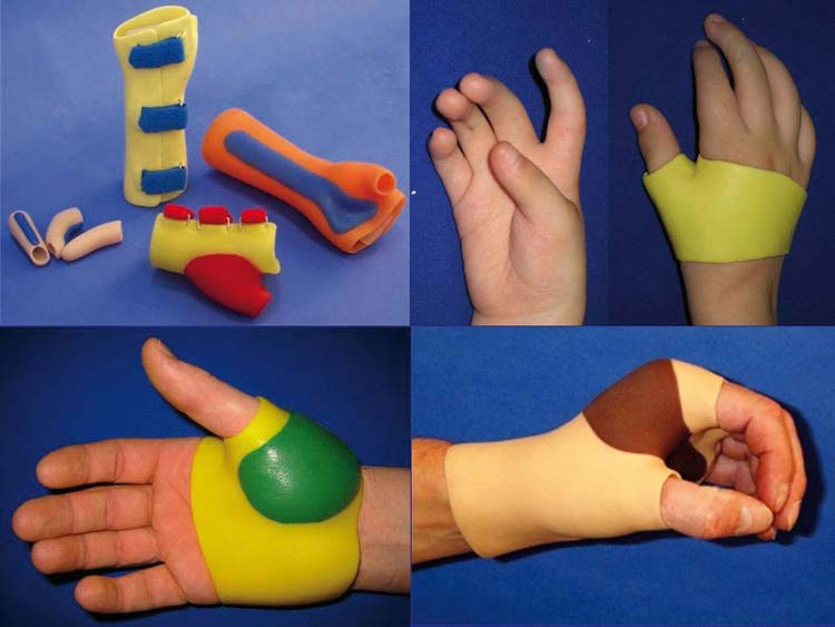 Silikon Orthese.jpg